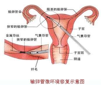 通草的功效与作用能通输卵管堵塞_绝对经典可信落实_战略版236.243.33.176